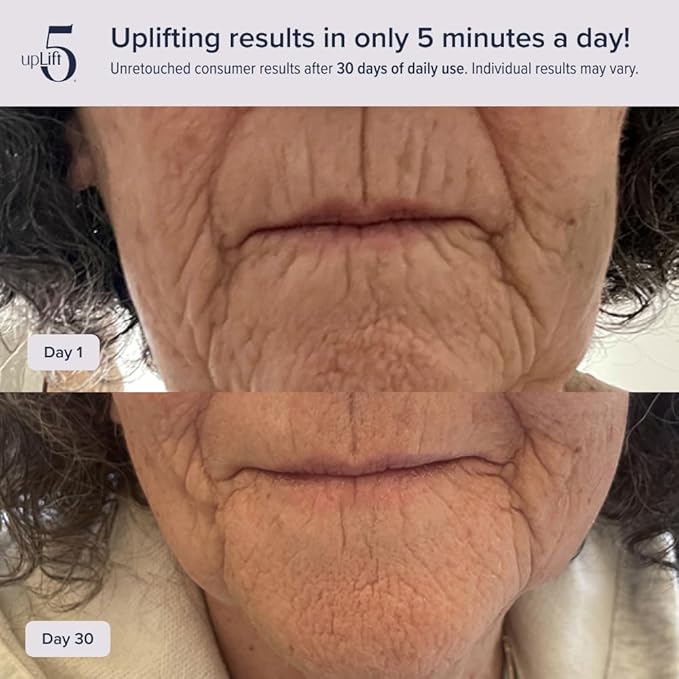upLift 5 Pulsating Facial Lift | 5 Minute Age Reversal Device, Contours & - Image 5