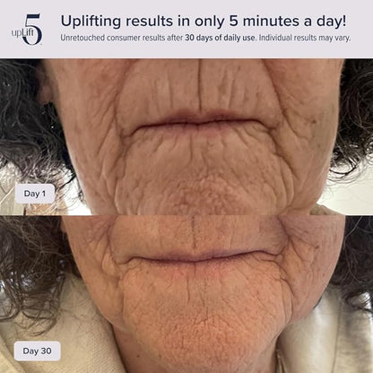 upLift 5 Pulsating Facial Lift | 5 Minute Age Reversal Device, Contours & - Image 5