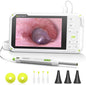 Anykit Digital Otoscope with Gyroscope, 4 Inches Screen, 3.9mm Ear Scope Camera by ANYKIT