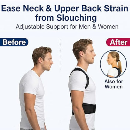 Back Posture Corrector Brace for Men & Women, Back-Anchored Shoulder Support - Image 2