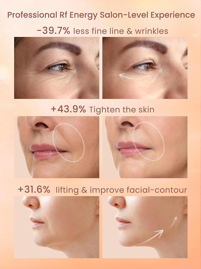 RF Radio Frequency Facial Device, 1MHz RF Machine - Image 2