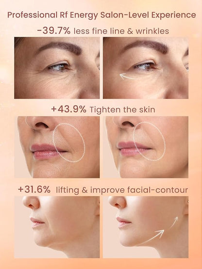 RF Radio Frequency Facial Device, 1MHz RF Machine - Image 2