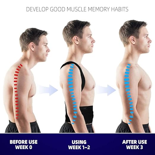 Upgraded Posture Corrector Back Brace - Image 3