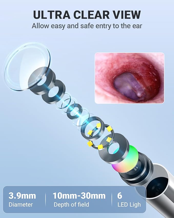 Anykit Digital Otoscope with Gyroscope, 4.5 Inches Screen, 3.9mm Ear Scope - Image 6