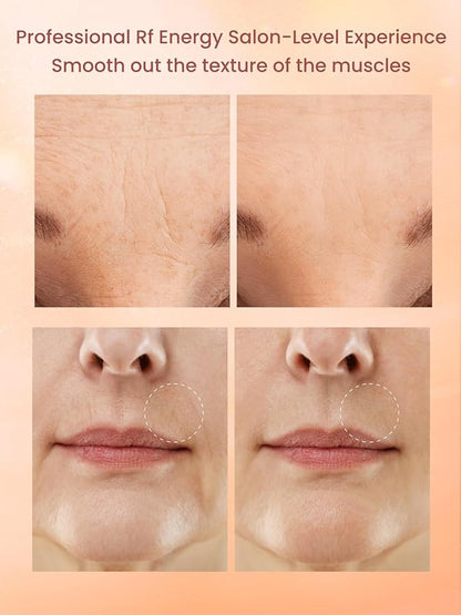 RF Radio Frequency Facial Device, 1MHz RF Machine - Image 7