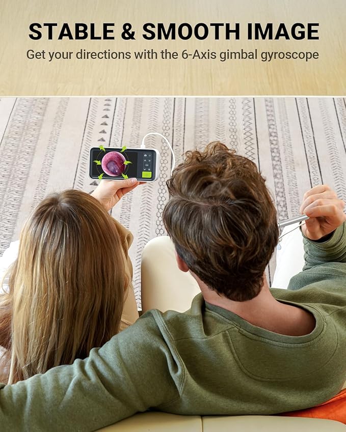 Anykit Digital Otoscope with Gyroscope, 4.5 Inches Screen, 3.9mm Ear Scope - Image 2