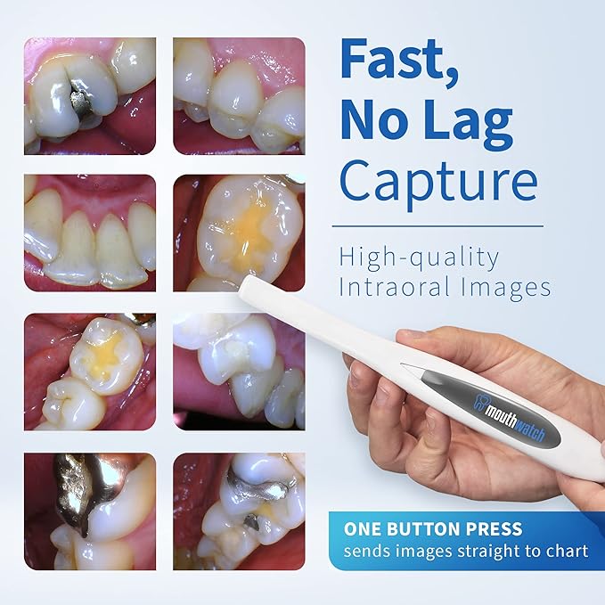 MouthWatch Intraoral Camera, Crystal Clear Images - Image 3