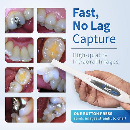 MouthWatch Intraoral Camera, Crystal Clear Images - Image 3