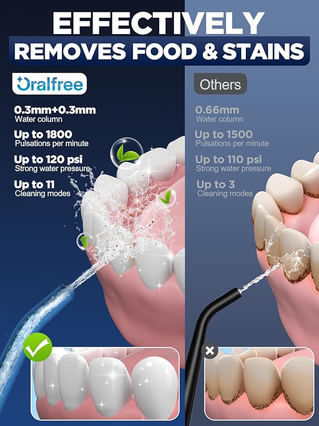 Oralfree Water Dental Flosser Cordless - Image 2