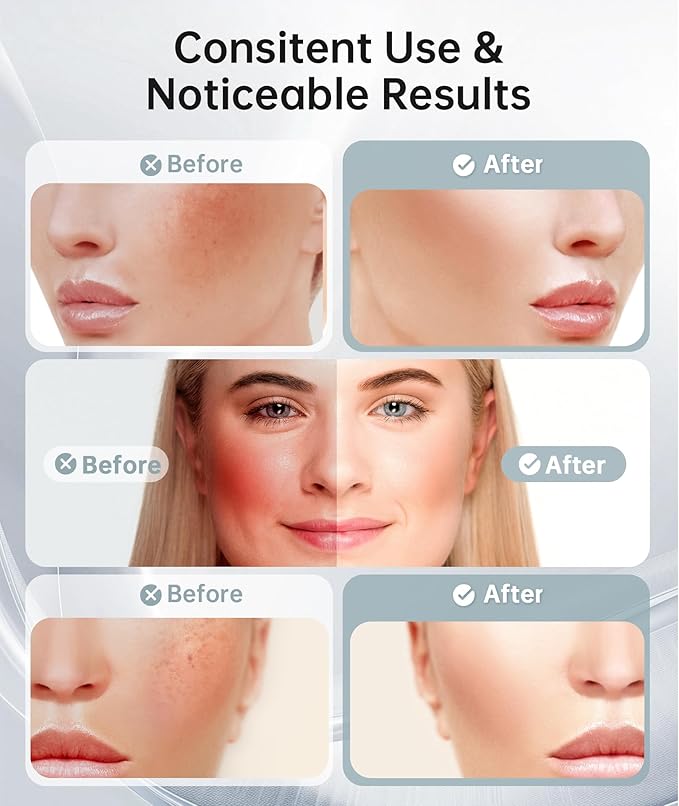 Dopsikn 7 Color Light Therapy Facial Massager - Image 3