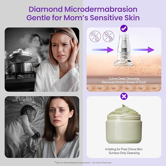 UNOISETION Diamond Microdermabrasion Machine Professional, 3 in 1 Dermabrasion - Image 2