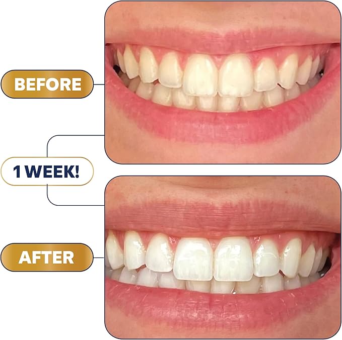 Lumineux Teeth Whitening Strips - Image 3