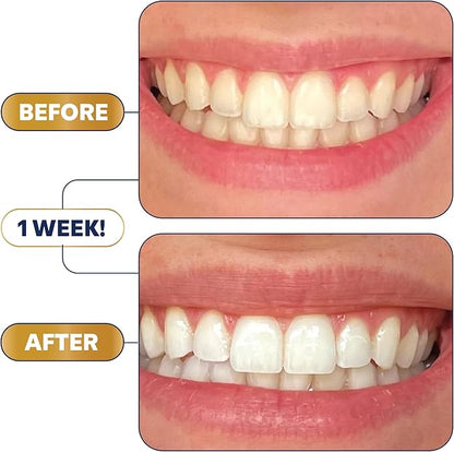 Lumineux Teeth Whitening Strips - Image 3