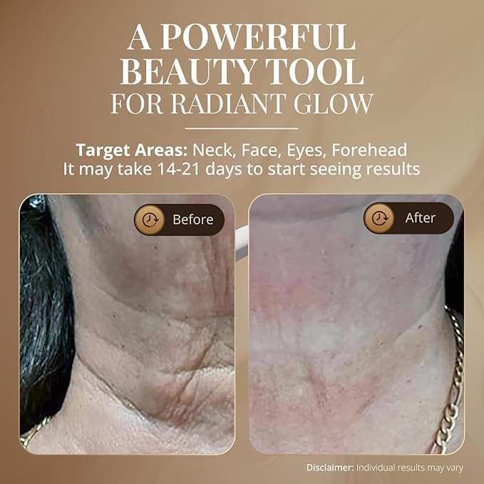 GLO24K Red Light for Face and Neck Beauty Device – Triple LED Action & - Image 4