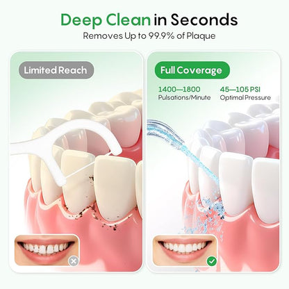 FRESKO Water Dental Flosser - Image 2