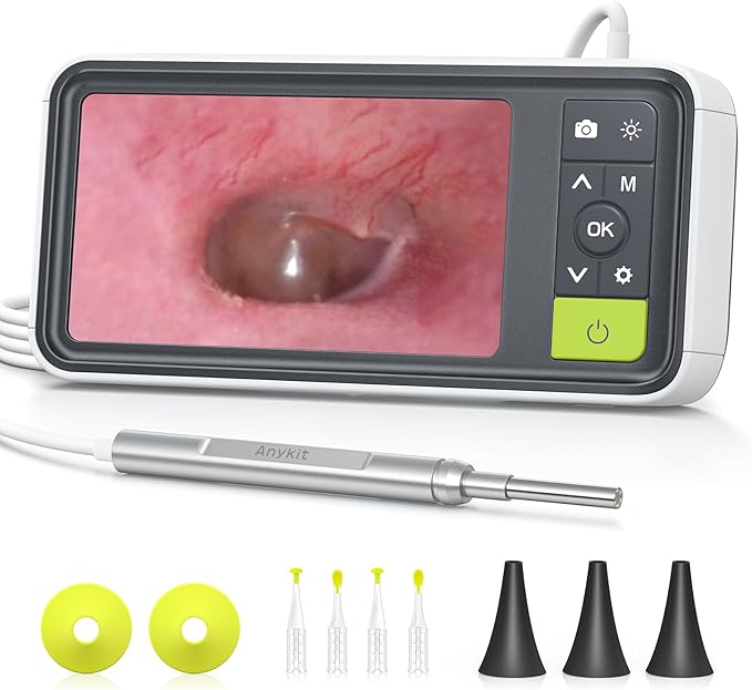 Anykit Digital Otoscope with Gyroscope, 4.5 Inches Screen, 3.9mm Ear Scope by ANYKIT