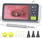 Anykit Digital Otoscope with Gyroscope, 4.5 Inches Screen, 3.9mm Ear Scope by ANYKIT