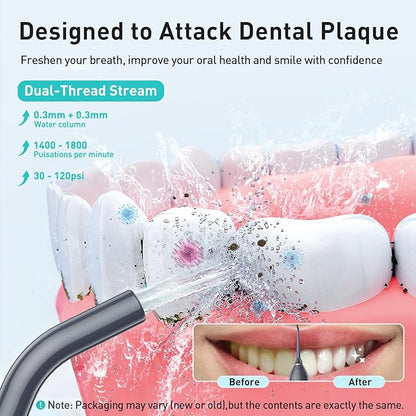 COSLUS Water Dental Flosser Teeth Pick: Portable Cordless Oral Irrigator 300ML - Image 2