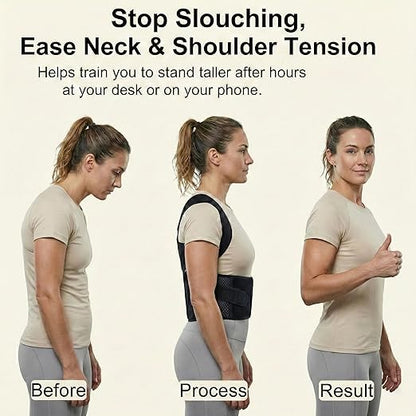 Full Back Posture Corrector for Women & Men – Pull-Back System Posture Brace – - Image 2