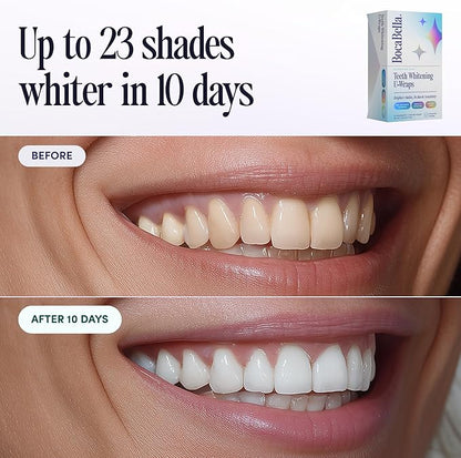 Boca Bella Teeth Whitening U-Wraps – 10 Treatments – 15% Hydrogen Peroxide - Image 4