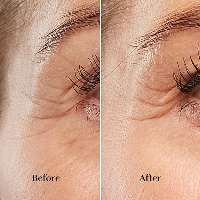 Silk’n Anti-Aging Device - Image 4