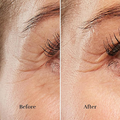 Silk’n Anti-Aging Device - Image 4