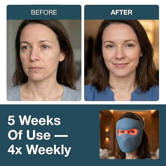myhalos® Red Light Therapy Face Mask - Image 3