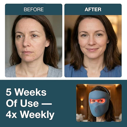 myhalos® Red Light Therapy Face Mask - Image 3