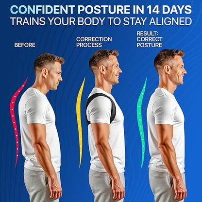 NEW 2026 Posture Corrector for Men & Women – Adjustable Figure-8 Back Brace for - Image 2